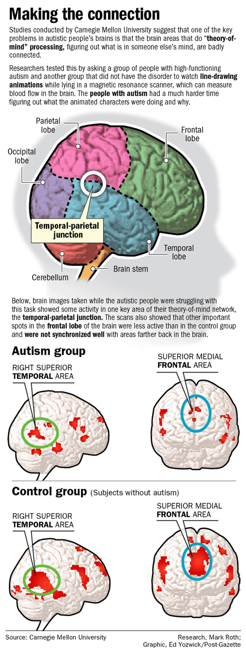 autism brain diagram